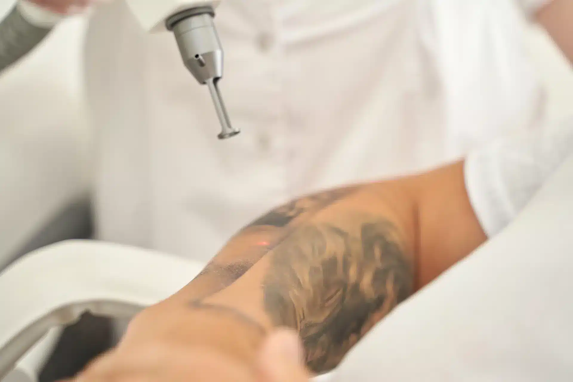 Tattoo removal laser visual for Cheongdam Aesthetics laser clinic details on a Korean aesthetic clinic page in Singapore
