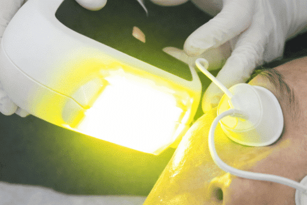 Yellow laser pairs with a pico laser package in Singapore to calm redness and support a brighter, smoother facial skin glow
