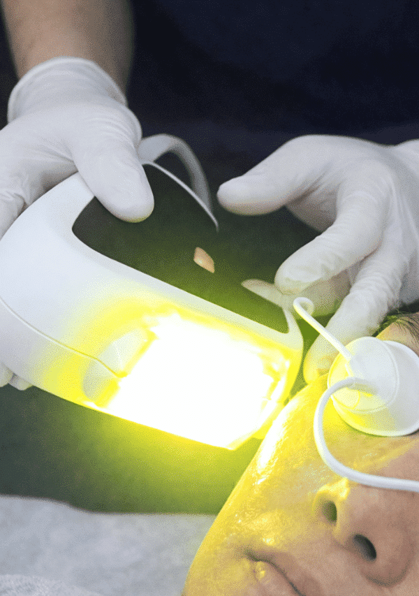 Yellow laser treatment in Singapore helps calm redness, brighten uneven tone and support clearer, more comfortable skin feel