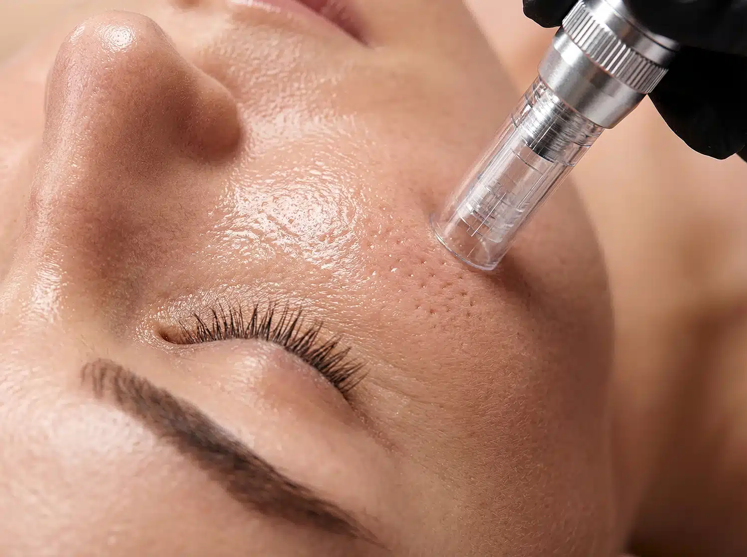 Skin rejuvenation treatment at Cheongdam Aesthetics is guided by a Korean aesthetic philosophy gradual, natural-looking results that work with your skin rather than against it